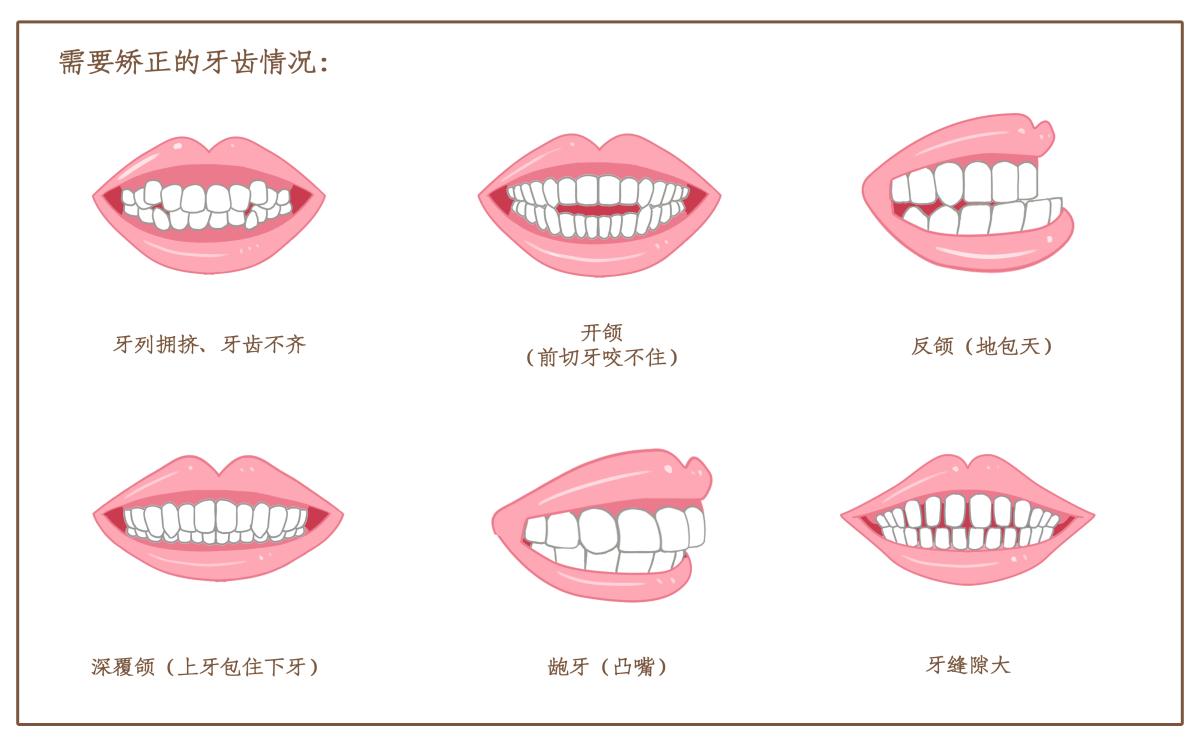 正畸企业商用）